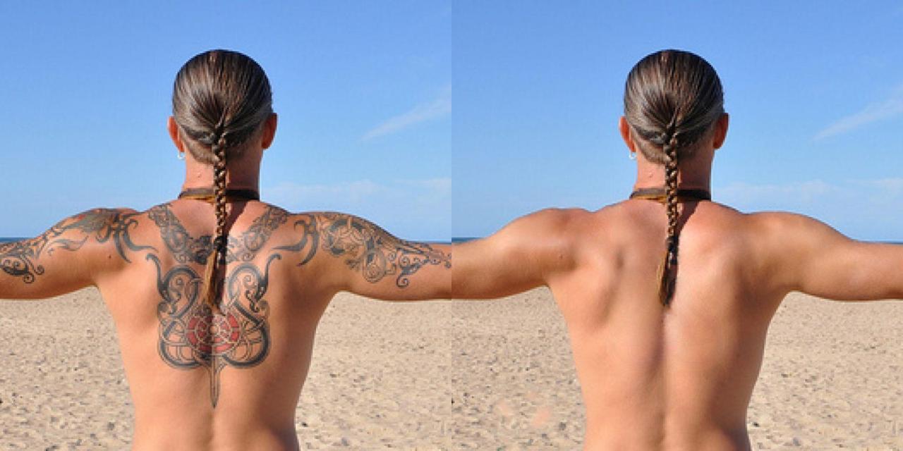 Tattoo remover example 1